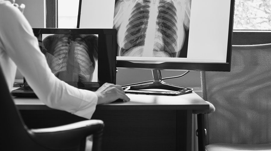 Removing Barriers to Low Dose CT Lung Screening Programs